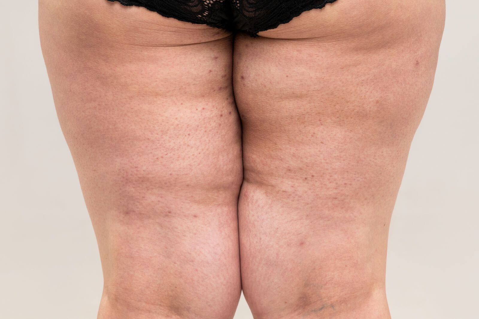 Foto: staras/shutterstock.com
